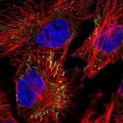 MIPEP Antibody, Novus Biologicals 0.1mL; Unlabeled:Antibodies, Polyclonal